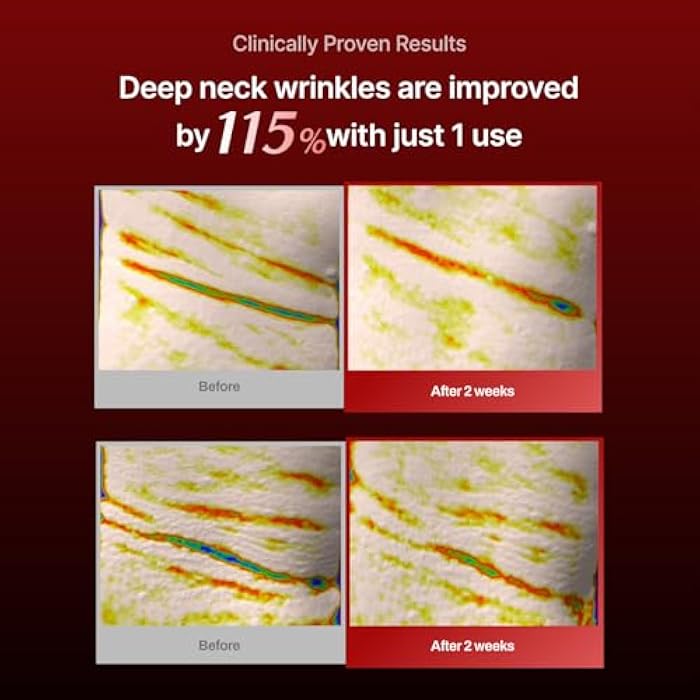 MEDITHERAPY Wrinkle-fit Neck Mask - Neck Wrinkle Patches, Firming and Tightening Korean Deep Collagen Masks - Hyaluronic Acid NeckTargeted Mesh Sheet Mask for Lifting Sagging Skin - Boosting Elasticity 7EA - Image 4