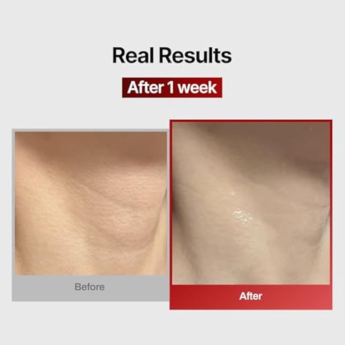 MEDITHERAPY Wrinkle-fit Neck Mask - Neck Wrinkle Patches, Firming and Tightening Korean Deep Collagen Masks - Hyaluronic Acid NeckTargeted Mesh Sheet Mask for Lifting Sagging Skin - Boosting Elasticity 7EA - Image 3