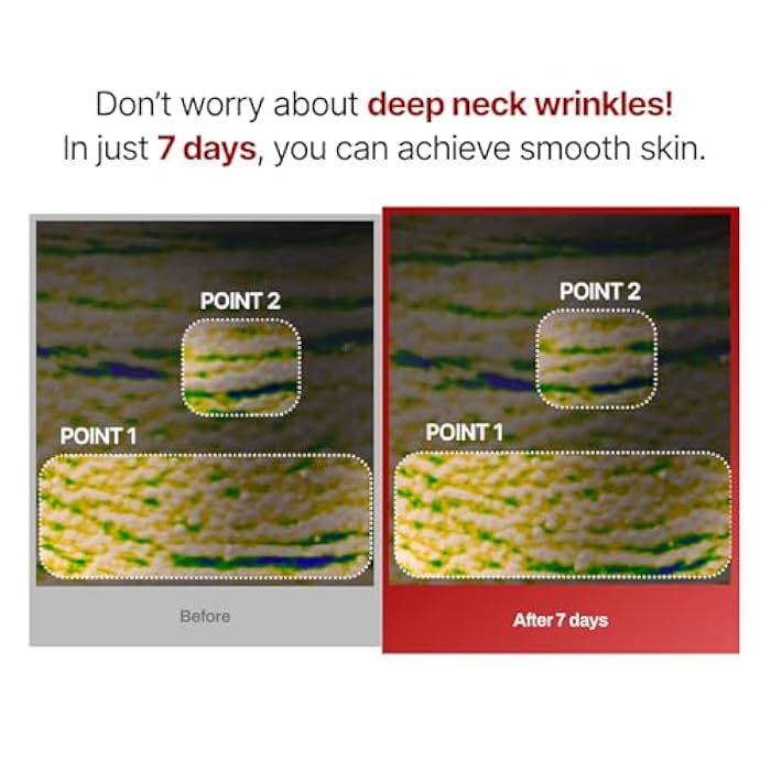 MEDITHERAPY Wrinkle-fit Neck Mask - Neck Wrinkle Patches, Firming and Tightening Korean Deep Collagen Masks - Hyaluronic Acid NeckTargeted Mesh Sheet Mask for Lifting Sagging Skin - Boosting Elasticity 7EA - Image 5