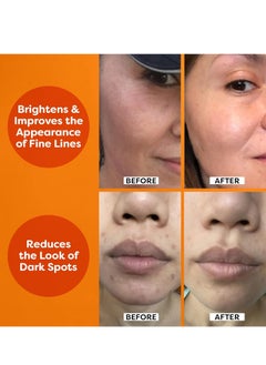 TruSkin TruSkin Vitamin C Serum For Face, Anti Aging Serum With Hyaluronic Acid, Vitamin E  - Image 4