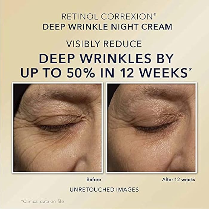 RoC Retinol Correxion Value Set Duo, Deep Wrinkle Anti-Aging Night Face Cream + Under Eye Cream for Dark Circles & Puffiness - Retinol Eye Care - Image 4