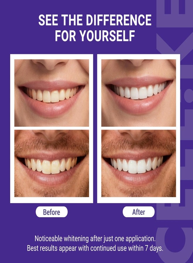 CEELIKE Teeth Whitening Strips (7 Treatments/14 Strips - Peroxide-Free Whitening Kit with Hydroxyapatite, Enamel Safe + Cheek Retractor, Easy 3-Step at-Home Teeth Whitening for Deep Stain Removal - Image 3