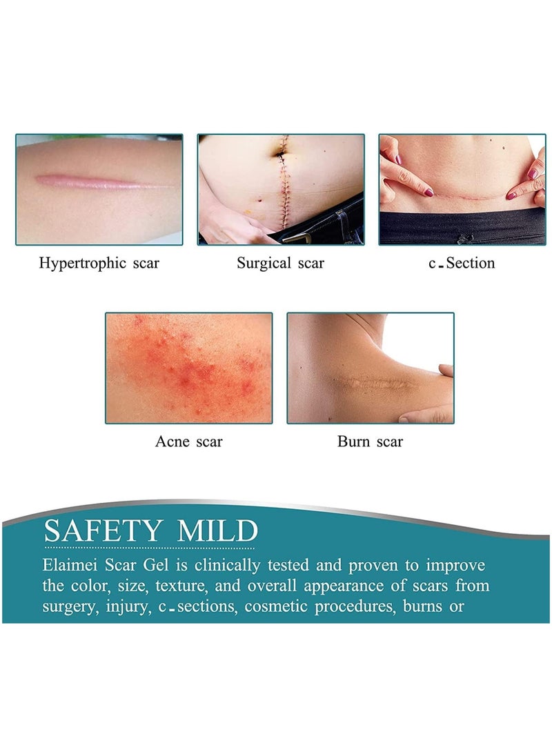 Elaimei - Elaimei Silicone Scar Sheets Soft Silicone Gel Scar Tape Painless Silicone Tape Roll - Effective Silicone Scar Removal Strips Sheets for C-Section & Keloid Surgery, Burn, Acne - Image 1