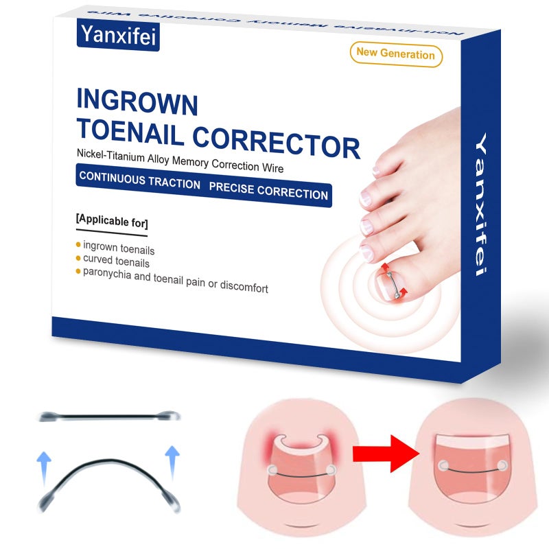 Yanxifei Nitinol Ingrown Toenail Corrector,at Home Ingrown Toenail Treatment,Curved Toenail Straightener,Ingrown Toe Nail Reliefï¼ŒIngrown Toenail Removal Kit (1/2 In,11/16 In) - Image 1