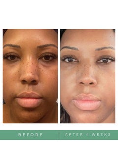 Replenix Glycolic Acid Resurfacing Cleanser Medical Grade Brightening Face Wash Exfoliating Reduces Appearance Of Pores Uneven Skin Tone 6.7 Oz.  - Image 5