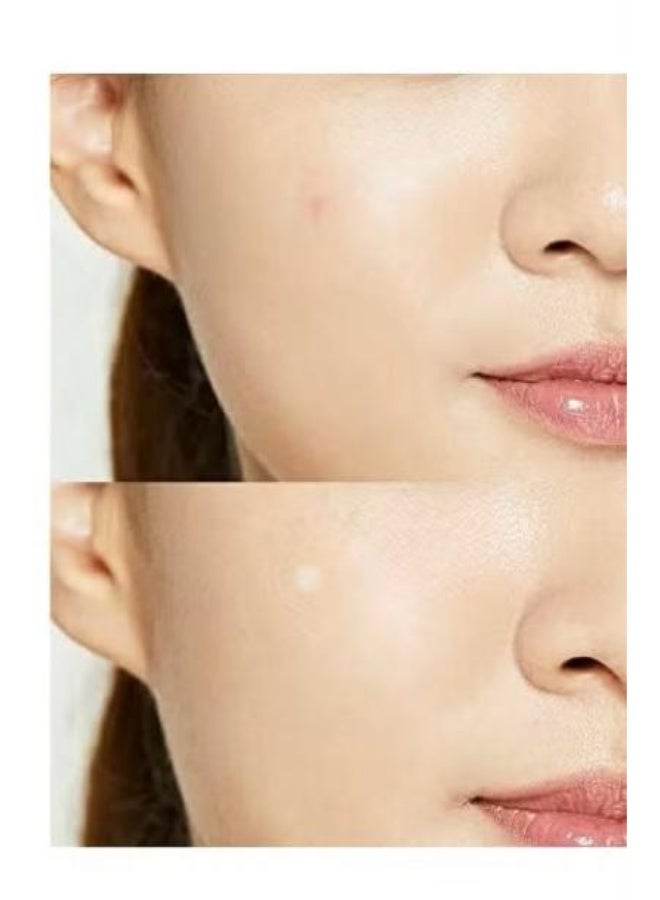 Cure aid 24 pieces for acne and sores in skin tone from Cure Aid (2-piece pack) - Image 2