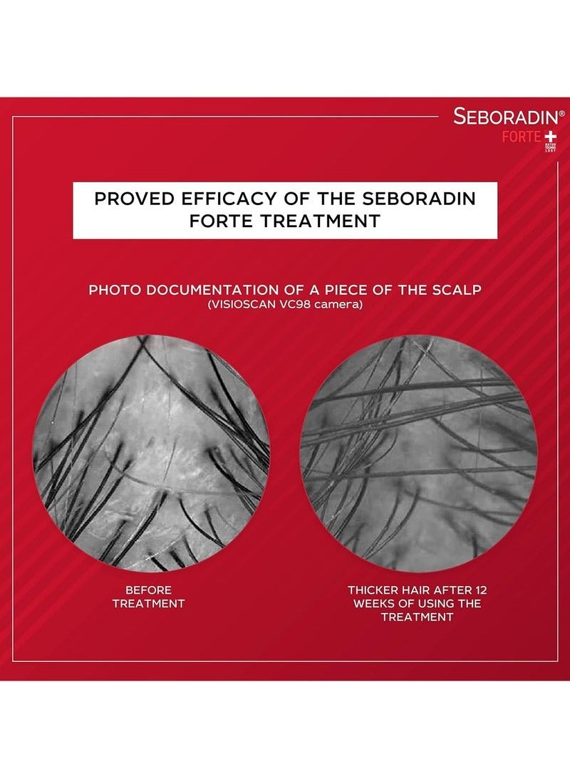 Seboradin Forte ampoules for the treatment of chronic hair loss and hair loss - Image 3
