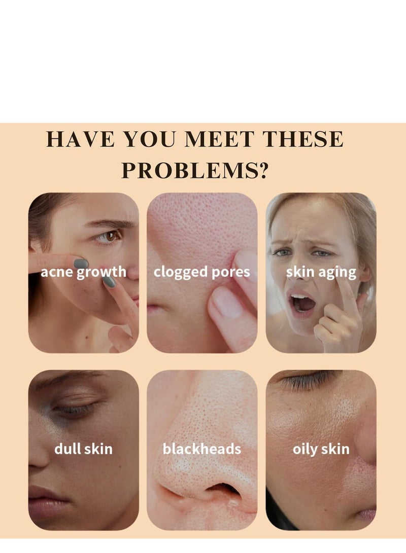 مويكا قناع الوجه بالكركم ، قناع طين فيتامين سي ، قناع المسام العميق ، قناع طين البشرة المشعة لتوازن الزيت ، للبشرة المتألقة ، توازن الزيت ، أقنعة الوجه العناية بالبشرة للمسام ، الرؤوس السوداء ، الشوائب 120 جم - Image 5