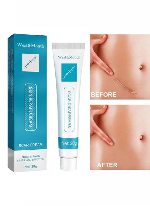 Scar Repair Cream - Dilute Hyperplasia Pregnancy Surgery Burn Scald Skin Repair Scar Cream 20g