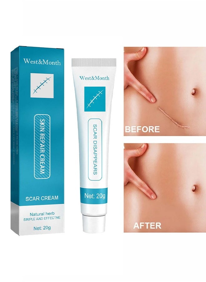 West&Month Scar Repair Cream - Dilute Hyperplasia Pregnancy Surgery Burn Scald Skin Repair Scar Cream 20g  - Image 1