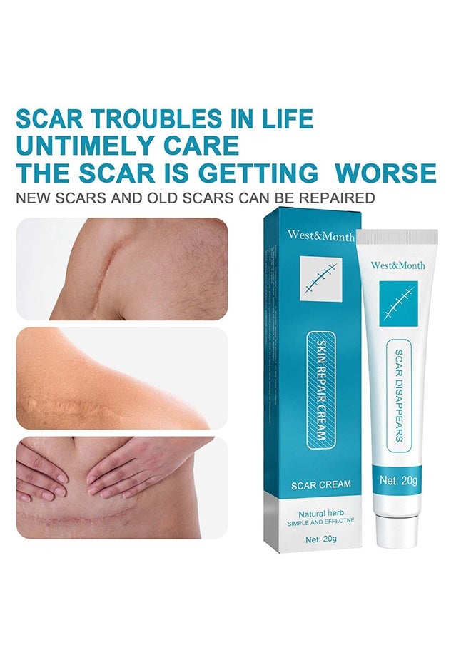West&Month Scar Repair Cream - Dilute Hyperplasia Pregnancy Surgery Burn Scald Skin Repair Scar Cream 20g  - Image 3