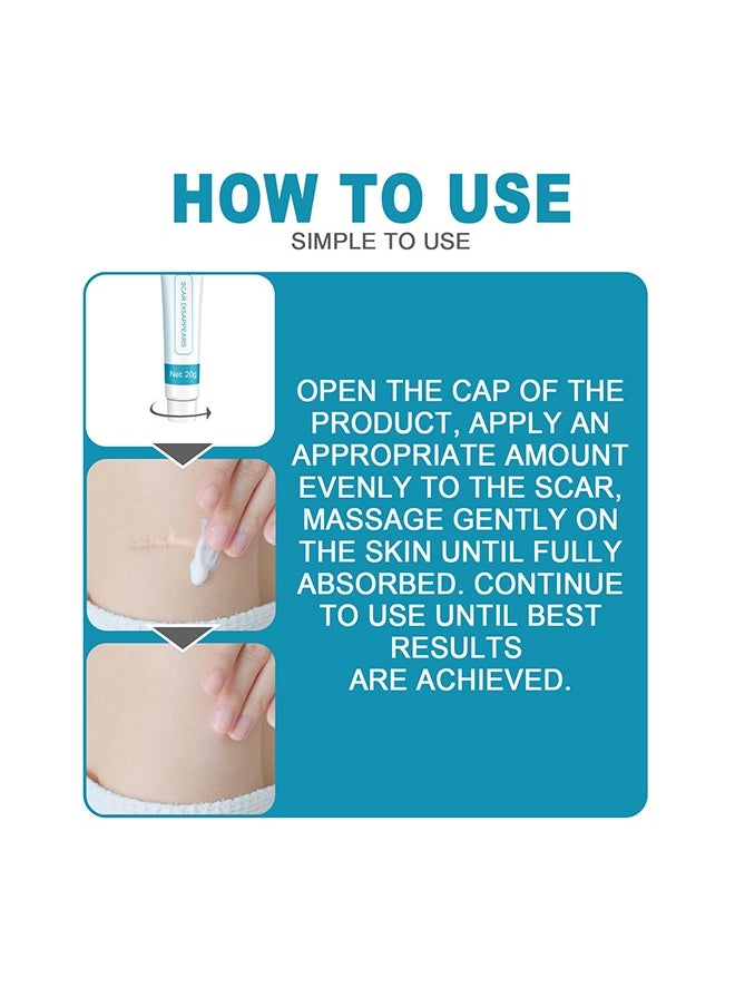 West&Month Scar Repair Cream - Dilute Hyperplasia Pregnancy Surgery Burn Scald Skin Repair Scar Cream 20g  - Image 5