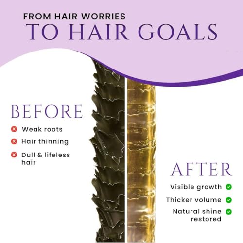 Nature Sure 150ml Rosemary Hair Oil for Healthy Hair with Bhringraj and Henna, Moisturises Dry Hair, Non Sticky & Non Greasy - Pack of 1 - Image 4