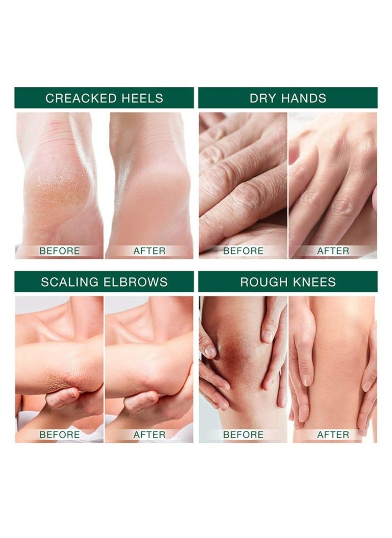 ISSUWEN - Hand and Foot Care 42% Urea Cream Intensive Moisturizes & Softens Skin Callus Remover Hand & Foot Cream for Dry Cracked Heels Elbows 100 g - Image 1