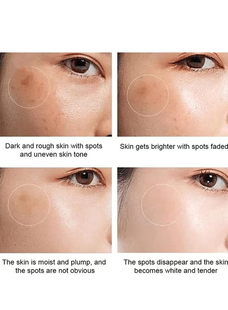 Hancy White Spot Cream, White Spot Corrector Cream, Dark Spot Remover for Face, Spot Whitening Cream, Skin Moisturizing Cream Gives Smooth Skin for All Skin Types. - Image 2