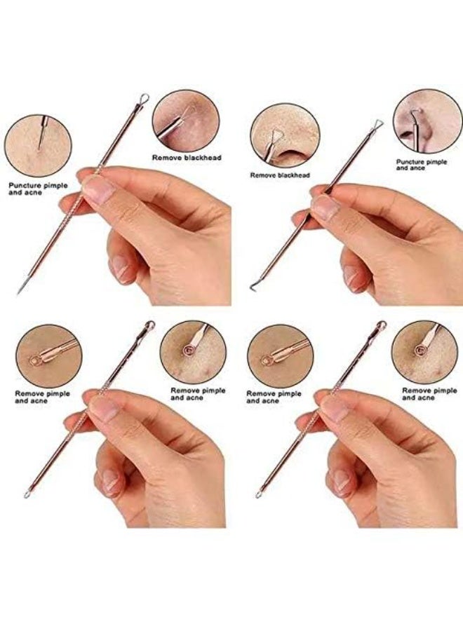 Remover Blackhead Remover Pimple Tool Kit, Set of 4 Stainless Steel Blackhead Removal Tool Pimple Popping Kit, Pimple Extractor Acne Tool - Image 3