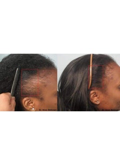 Infinix Black Seed Oil For Powerful Hair Growth Thick And Full  - Image 1