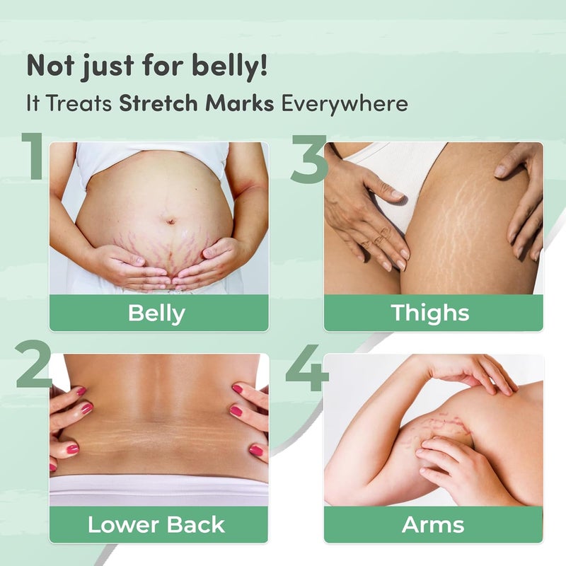 Mylo Stretch Marks Cream 100 gm Stretch Mark Oil 100 mlStretch Marks removal for women Made Safe CertifiedSafe in pregnancy effective on all body parts - Image 4