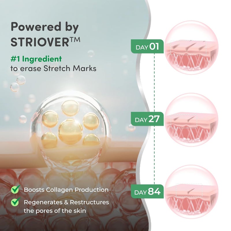 Mylo Stretch Marks Cream 100 gm Stretch Mark Oil 100 mlStretch Marks removal for women Made Safe CertifiedSafe in pregnancy effective on all body parts - Image 2
