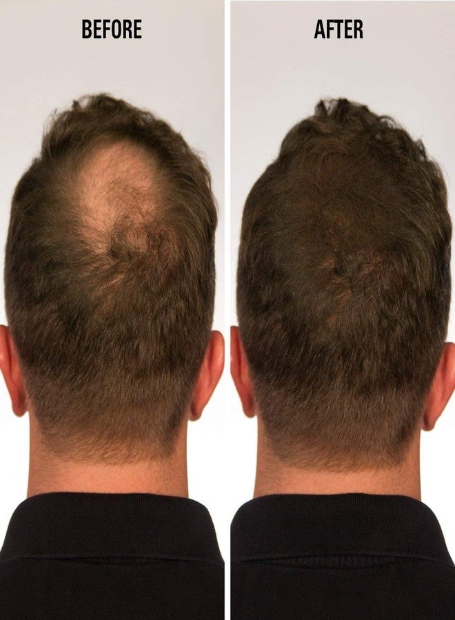 إيكليبس إنستانت هير فيلر ألياف إكليبس للشعر الخفيف (أبيض) للنساء والرجال - ألياف غير مرئية بنسبة 100% - عبوة 15 غرام - تخفي تساقط الشعر تمامًا في 15 ثانية - Image 5