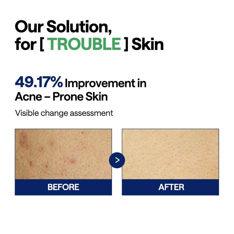 MEDIHEAL وسادة ميديهيال تي تري تروبل - وسادات قطنية مربعة لتونر الوجه مع شجرة الشاي ولبن الزبادي - مهدئة لتهدئة البشرة الحساسة والمعرضة لحب الشباب - شاش وجه نباتي 100 - Image 4