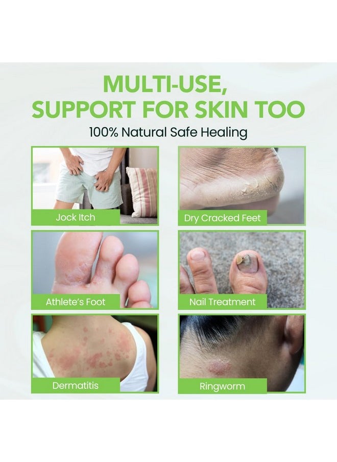 THENA Natural Wellness - THENA Natural Wellness Athletes Foot Balm Extra Strength, Athletes Foot Treatment Cream, Heals Dry Cracked Feet Heels Itchy Skin Nails Toenails Advanced Foot Care for Men Women - Image 1