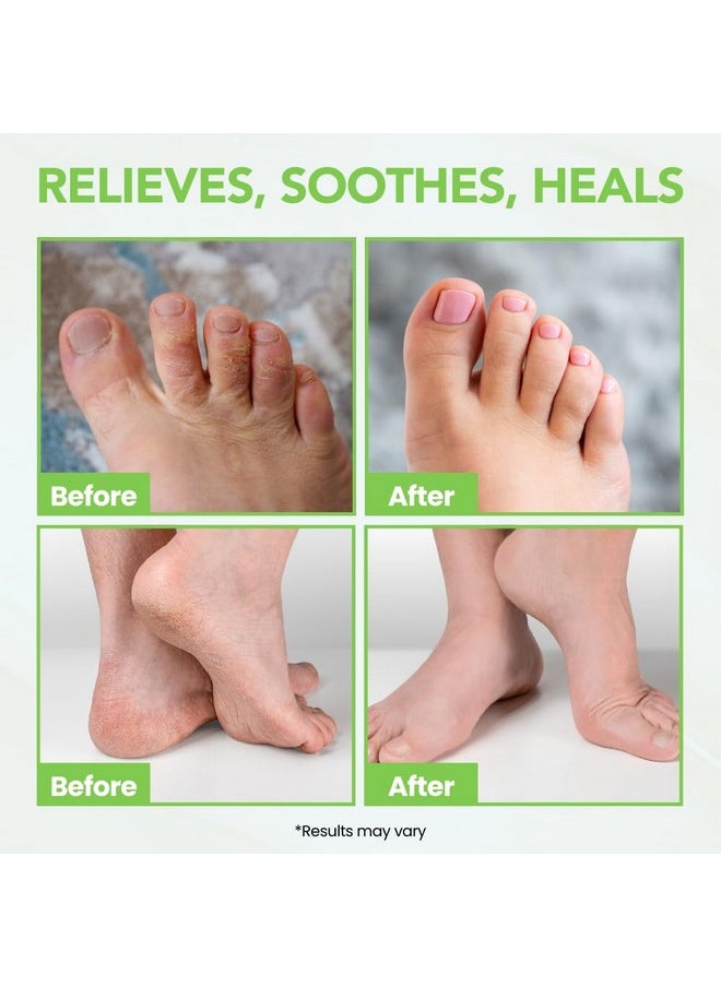 THENA Natural Wellness - THENA Natural Wellness Athletes Foot Balm Extra Strength, Athletes Foot Treatment Cream, Heals Dry Cracked Feet Heels Itchy Skin Nails Toenails Advanced Foot Care for Men Women - Image 1