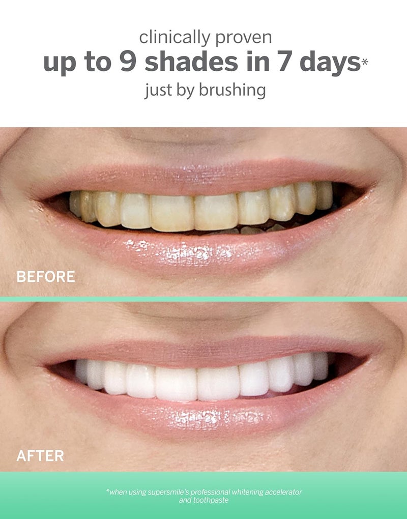 Supersmile Professional Extra Whitening Toothpaste for Adults  Tooth Stain Remover  Safe  Effective Teeth Whitener for Sensitive Teeth Triple Mint 7 oz - Image 3