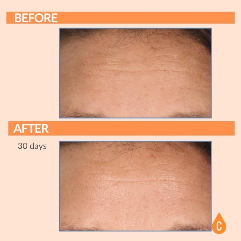 Serious Skincare - Serious-C3 Plasma Vitamin C Restore - Restoration Night Cream for Deep Hydration - Hydrolyzed Collagen - Hydrating Moisture for Face and Neck - 1.7 oz. - Image 5