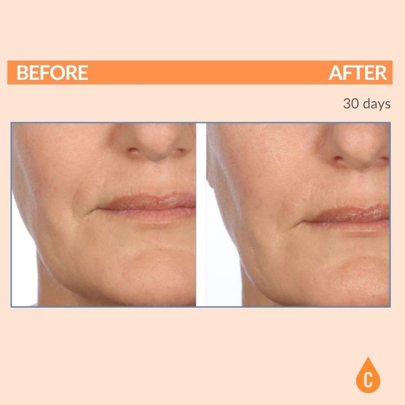 Serious Skincare - Serious-C3 Plasma Vitamin C Restore - Restoration Night Cream for Deep Hydration - Hydrolyzed Collagen - Hydrating Moisture for Face and Neck - 1.7 oz. - Image 4