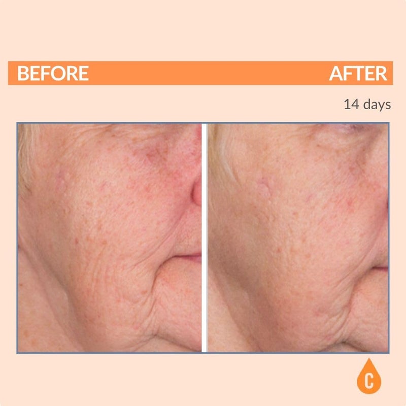 Serious Skincare - Serious-C3 Plasma Vitamin C Restore - Restoration Night Cream for Deep Hydration - Hydrolyzed Collagen - Hydrating Moisture for Face and Neck - 1.7 oz. - Image 3