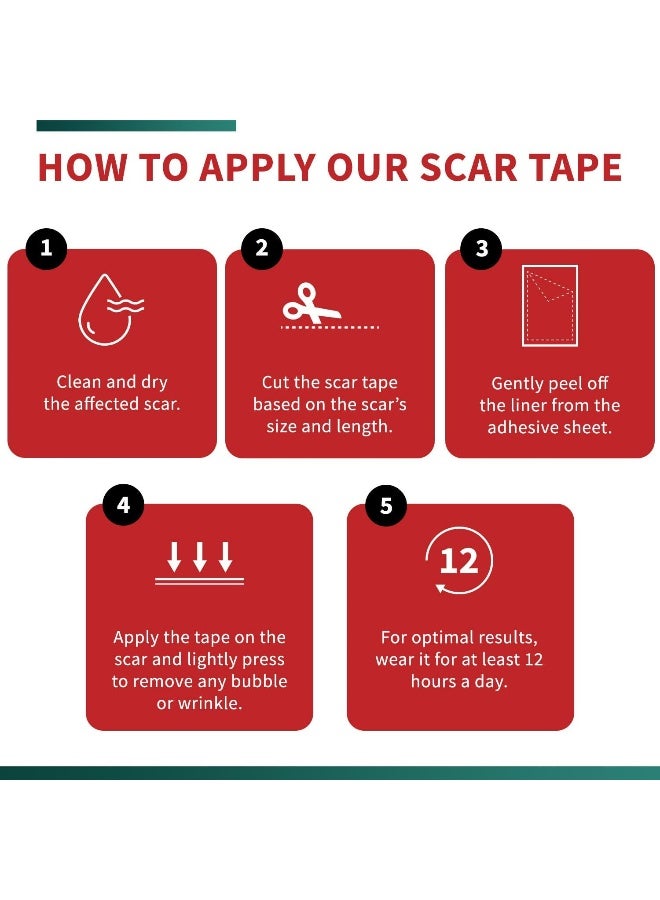 Protect Life Medical-Grade Silicone Scar Tape Roll (4Cm X 300Cm Roll) - Keloid Bump Removal Scar Sheets - Reusable Silicone Tape Scar Removal Strips, Scar Tape For Surgical Scars, C Section Scar Silicone Strips 