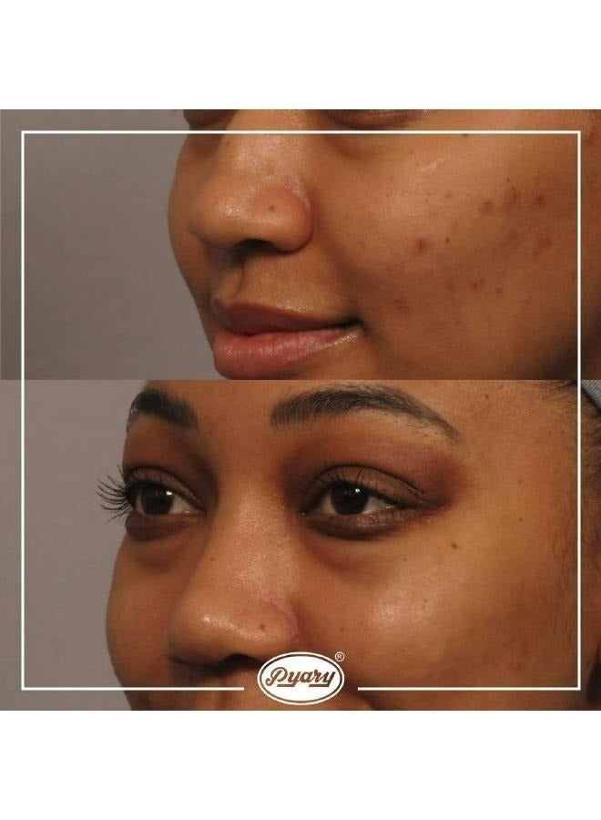 Pyary Pack of 4 All Natural Handmade Ayurvedic Turmeric Soap Bars 75g - Image 2