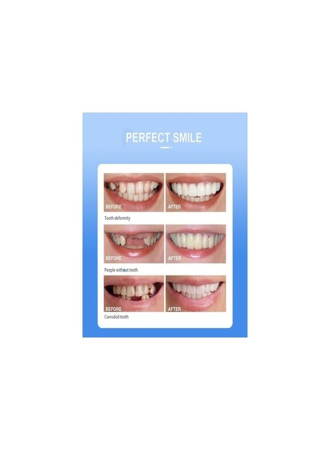 KERFORA Snap On Veneers Teeth for Men and Women - Moldable False Teeth and Dentures Replacement Kit for Missing Teeth, with Teeth Grinding Guard, Best Whitening Strips and Fake Braces for Bad Teeth - Image 5