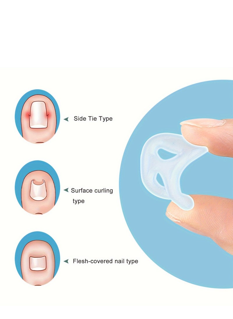 Generic - 5 pcs Toe Protector Pad Ring, Toe Sleeve, Stretchable, Reusable, Ingrown Toenail Correction Spacer - Image 1