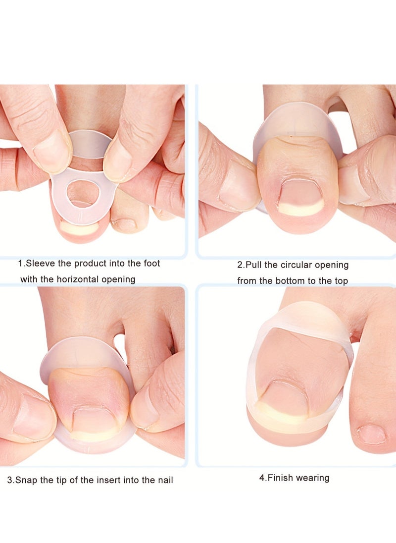 Generic - 5 pcs Toe Protector Pad Ring, Toe Sleeve, Stretchable, Reusable, Ingrown Toenail Correction Spacer - Image 1