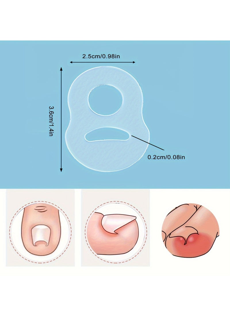 Generic - 5 pcs Toe Protector Pad Ring, Toe Sleeve, Stretchable, Reusable, Ingrown Toenail Correction Spacer - Image 1