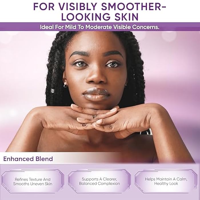 Aobbiy Azelaic Acid Cream for Face: Redness-Soothing Azelaic Acid Facial Cream for Uneven Tone, Blemish-Prone Skin, Pore Care and Skin Clarity Support, 1 oz - Image 4