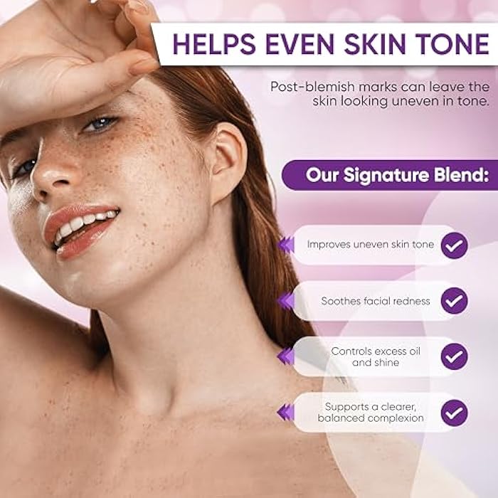 Aobbiy Azelaic Acid Cream for Face: Redness-Soothing Azelaic Acid Facial Cream for Uneven Tone, Blemish-Prone Skin, Pore Care and Skin Clarity Support, 1 oz - Image 5