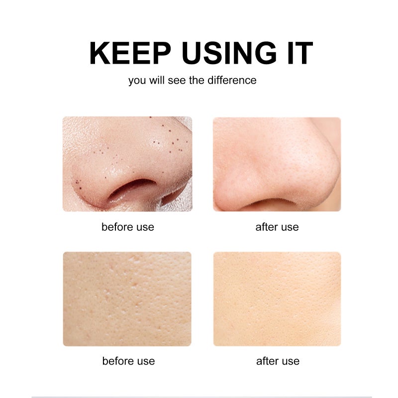 Skin Scrubber Face Spatula Rechargeable Facial Cleansing Scraper Pores Cleanser Blackhead Removal Acne Extractor Skin Exfoliation Beauty Device - Image 3