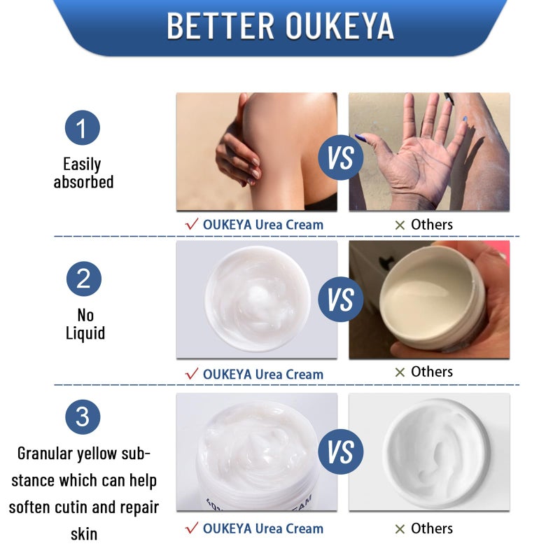 OUKEYA Urea Cream 40 Percent,Foot & Hand Cream for Dry Cracked,Urea Lotion for Feet Maximum Strength - Image 5