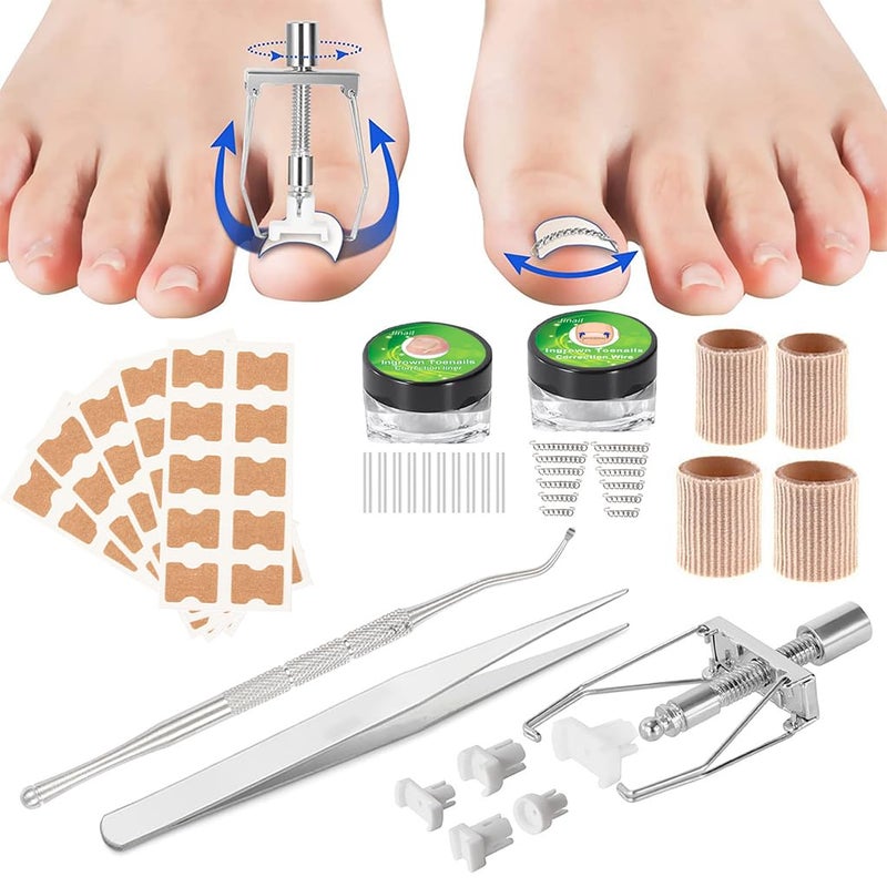 HANNEA Ingrown Toenail Treatment Kit Professional Ingrown Toenail Corrector Patch and Ingrown Toenail Corrector Strips Podiatry Toenail Braces for Corrects And Relieves Toenail Pain - Image 1