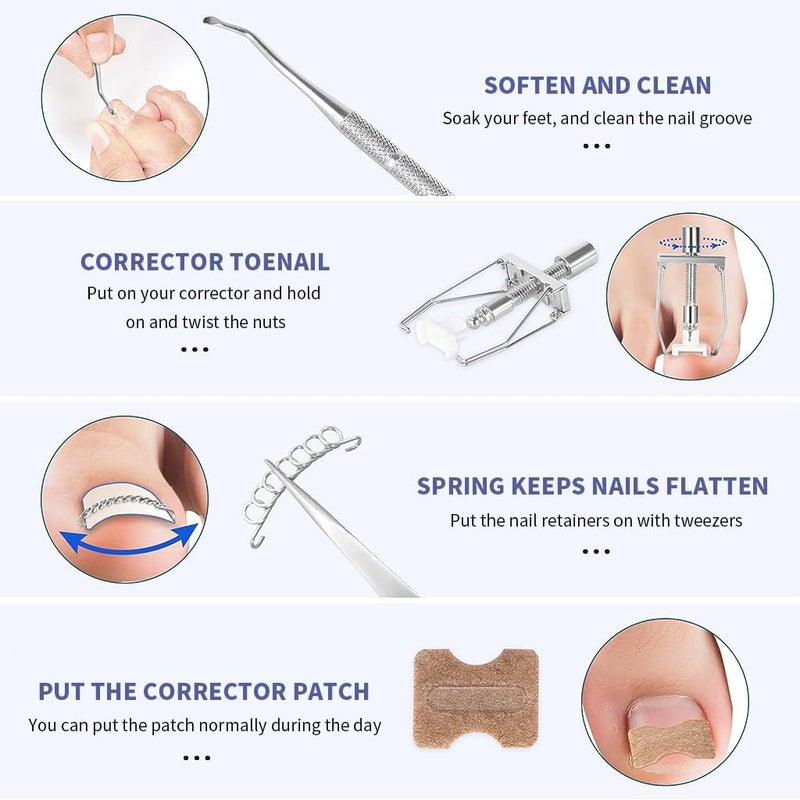 HANNEA Ingrown Toenail Treatment Kit Professional Ingrown Toenail Corrector Patch and Ingrown Toenail Corrector Strips Podiatry Toenail Braces for Corrects And Relieves Toenail Pain - Image 4