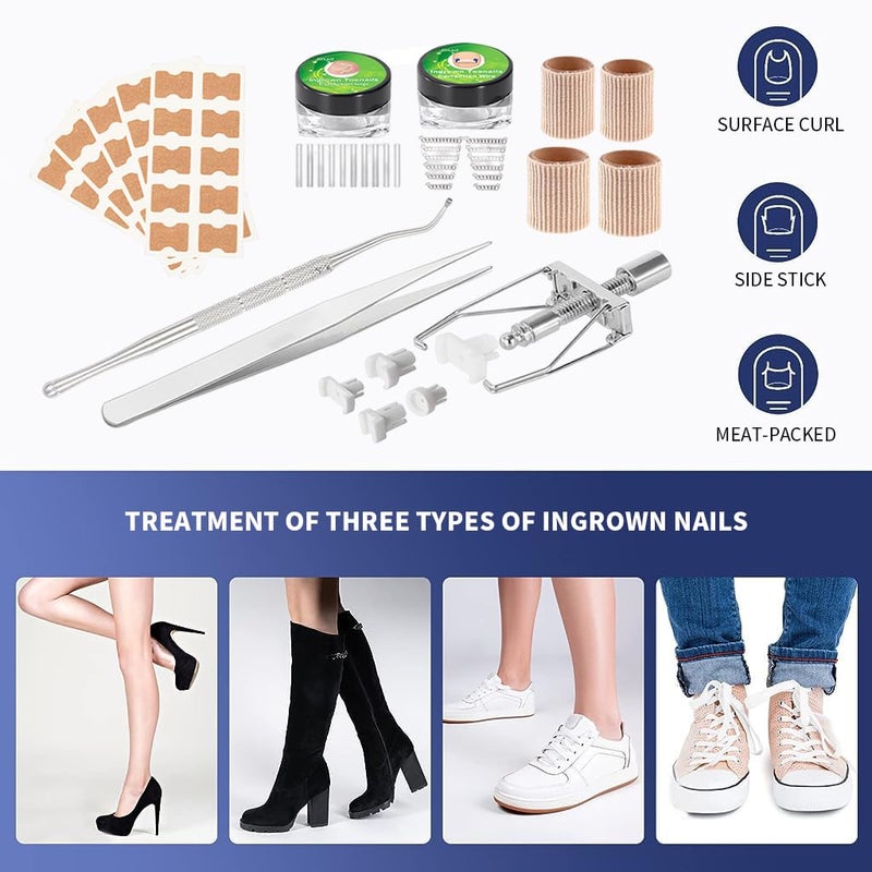 HANNEA Ingrown Toenail Treatment Kit Professional Ingrown Toenail Corrector Patch and Ingrown Toenail Corrector Strips Podiatry Toenail Braces for Corrects And Relieves Toenail Pain - Image 2