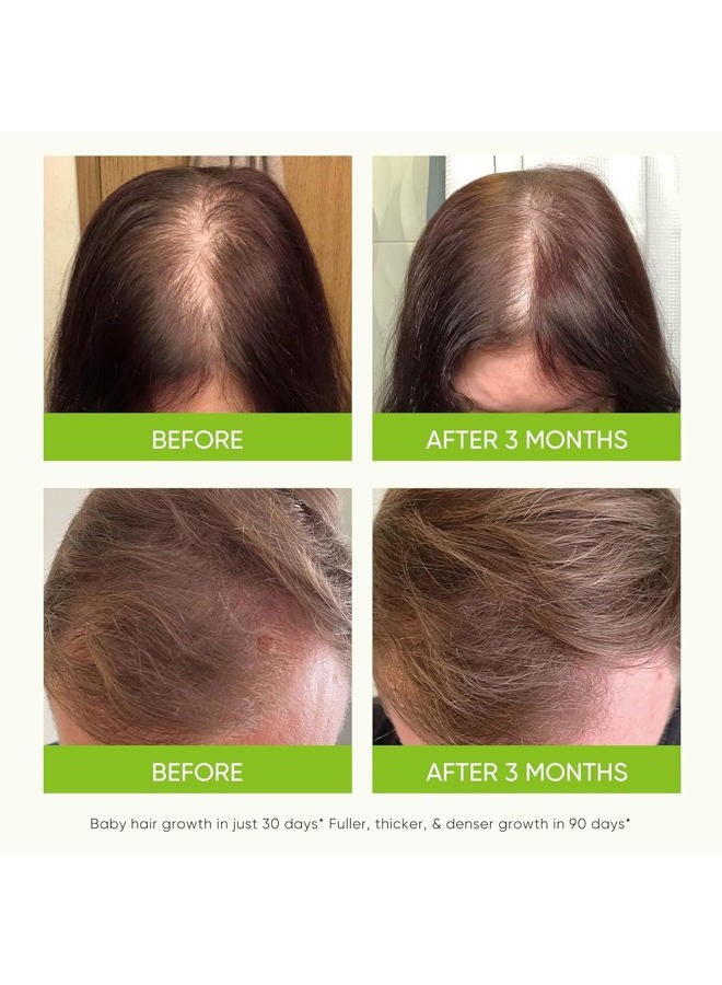 Svvimer Hair Growth Serum Spray - with Rosemary Batana Oil Biotin for Hair Loss and Thinning - Thicker Fuller Longer - for Women and Men 2.7 Fl Oz (Pack of 1) - Image 3