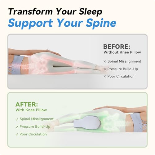 UJPFEO Knee Pillow for Side Sleepers,Leg Pillows for Sciatica,Knees,HIPS,Joints Between Legs,Back Pain Relief When Side Sleeping Spine Alignment Support for Knee Surgery Recovery - Image 2