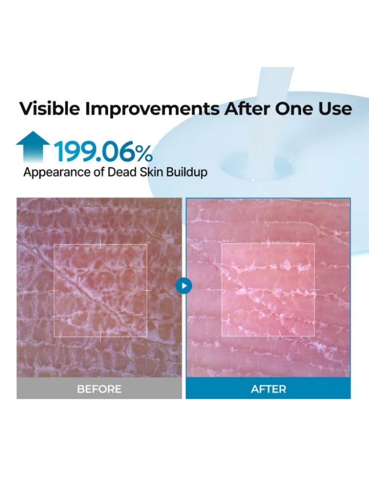 دكتور ميلاكسين د. ميلاكسين Peel Shot Exfoliating TX Spray - بخاخ مقشر ومفتح للوجه للبشرة الباهتة وتفاوت اللون وتنعيم الملمس - Image 5