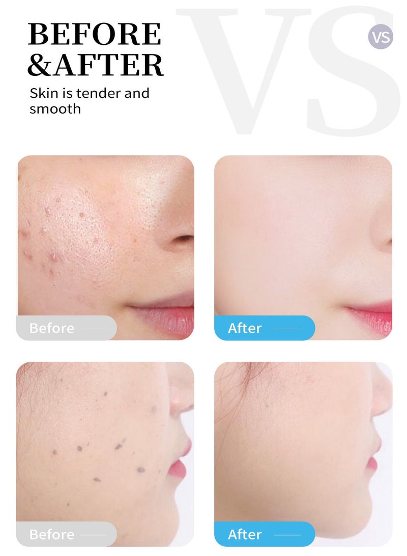 آر توب آر 40 جرام كريم تقشير المانجو تنظيف عميق مغذي وترطيب الوجه مقشر التقشير جل منتج العناية بالبشرة - Image 2