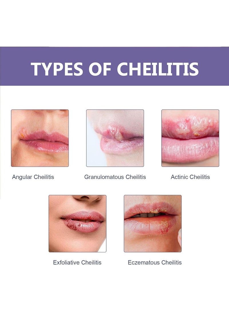 EELHOE Moisturising Plasters for Lips, 36pcs Nourishing Lip Plasters, Invisible Herpes Patches, Invisible Plasters Against Herpes, Lip Moisturising Plasters, Effective Herpes Patch - Image 2