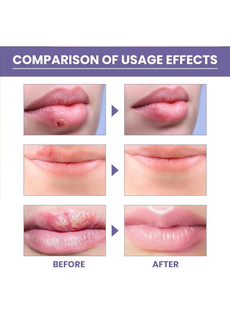 EELHOE Moisturising Plasters for Lips, 36pcs Nourishing Lip Plasters, Invisible Herpes Patches, Invisible Plasters Against Herpes, Lip Moisturising Plasters, Effective Herpes Patch - Image 3